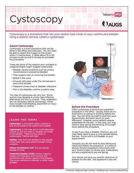 Cystoscopy