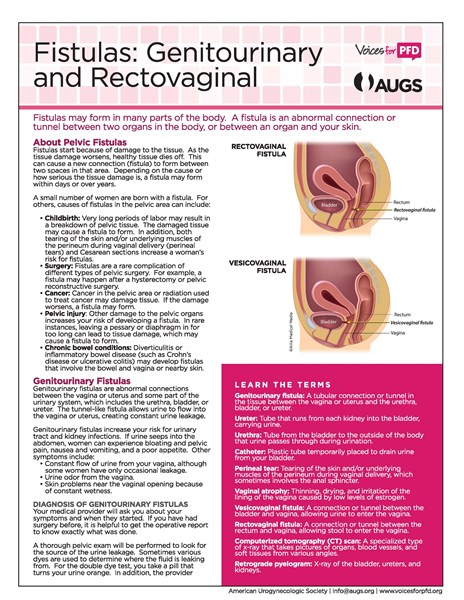 Fistulas_Page_1