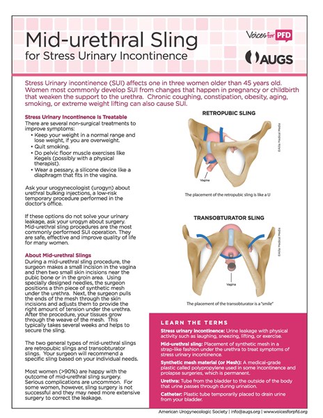 Mid-Urethral_Sling