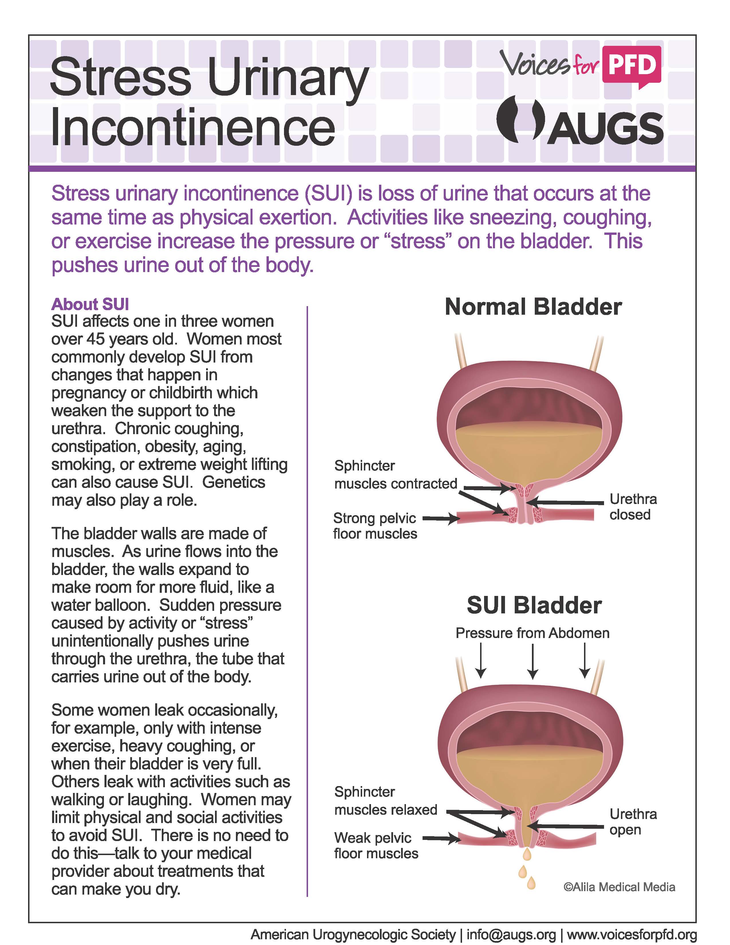 Stress Urinary Incontinence